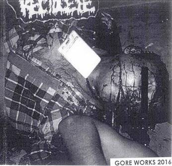 Rectocele : Gore Works 2016